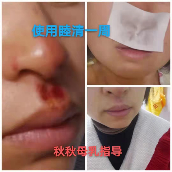 �����澏���N���Æ������M�߿ڱ������������a(ch��n)ƷȦ�۟o��(sh��)