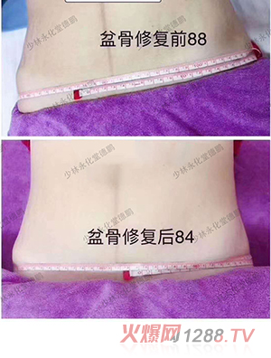 ���������îa(ch��n)���(xi��ng)Ŀ-�����ޏ�(f��)